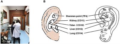 Use of Transcutaneous Auricular Vagus Nerve Stimulation as an Adjuvant Therapy for the Depressive Symptoms of COVID-19: A Literature Review